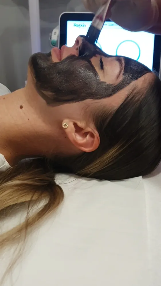 Nanošenje ugljične maske kistom