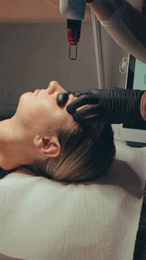 Laserski rad na području obrva uz zaštitu očiju